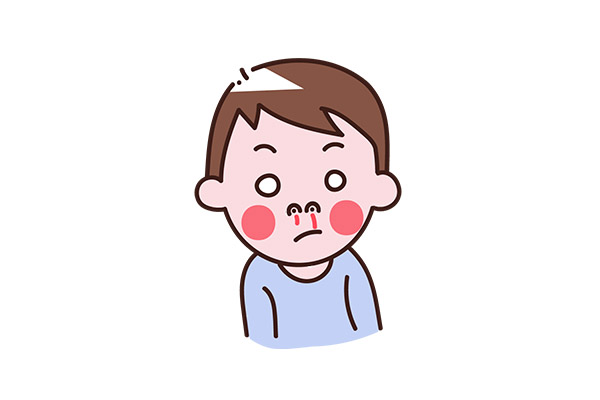 鼻子出血是什么原因 鼻子出血是怎么回事(图2)
